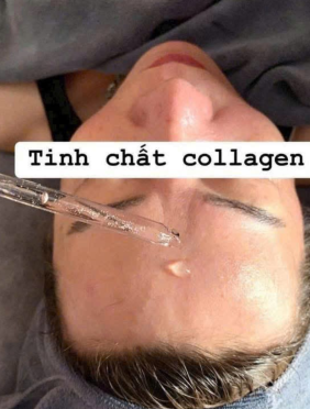 Tinh Chất Collagen