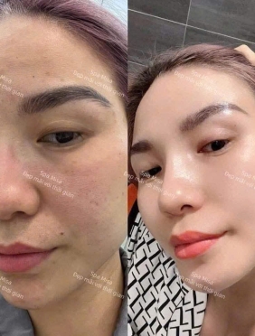 Trẻ Hóa Làn Da